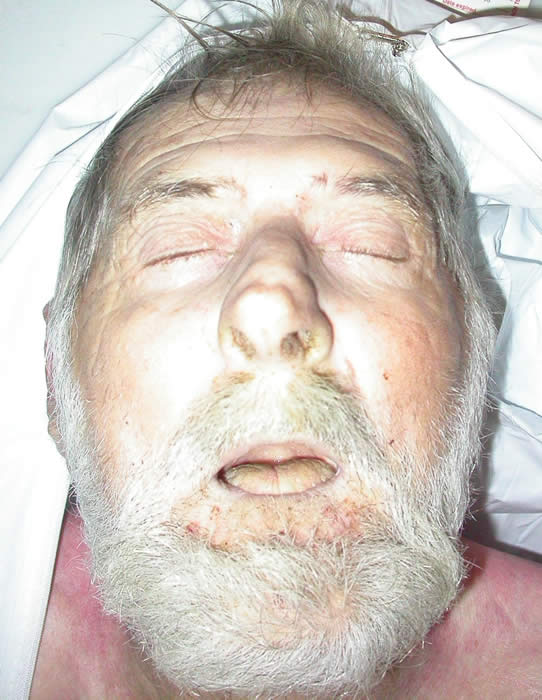 Unidentified White Male Found In Greene County, Mo.
